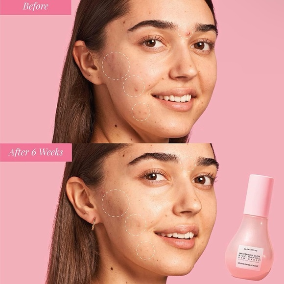 GLOW RECIPE- WATERMELON GLOW NIACINAMIDE
DEW DROPS | 10ML - Picture 6 of 12